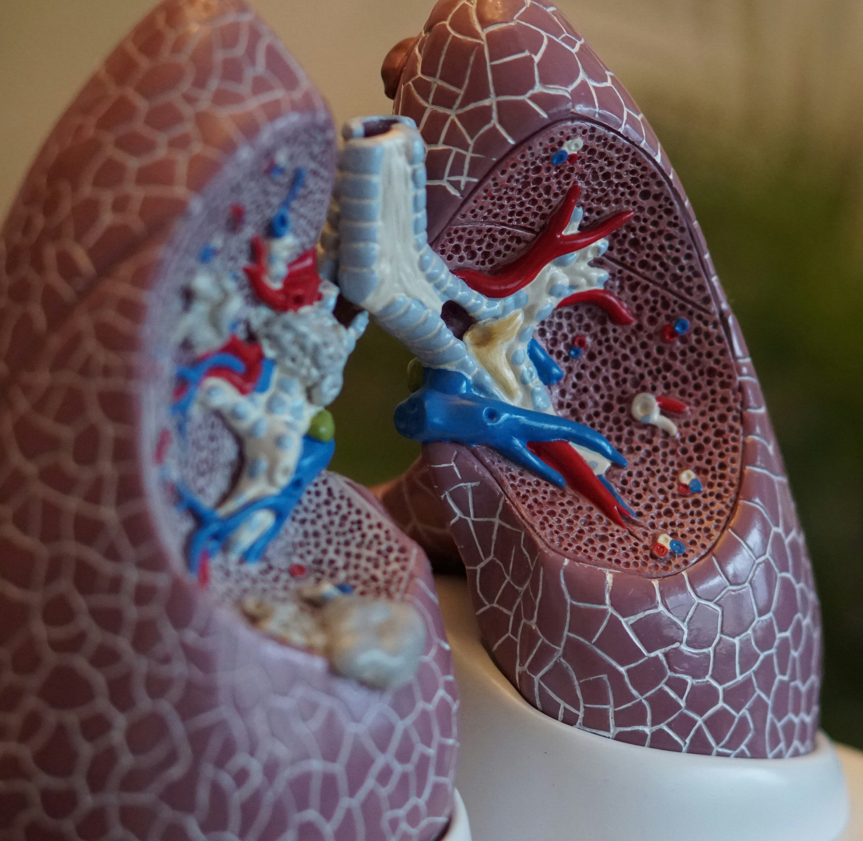 pulmones